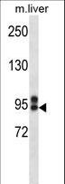 ABCC12 / MRP9 Antibody - ABCC12 Antibody western blot of mouse liver tissue lysates (35 ug/lane). The ABCC12 antibody detected the ABCC12 protein (arrow).