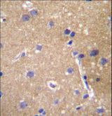 ABCC12 / MRP9 Antibody - ABCC12 Antibody immunohistochemistry of formalin-fixed and paraffin-embedded human brain tissue followed by peroxidase-conjugated secondary antibody and DAB staining.