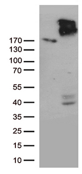 ABCC2 / MRP2 Antibody - HEK293T cells were transfected with the pCMV6-ENTRY control. (Left lane) or pCMV6-ENTRY ABCC2. (Right lane) cDNA for 48 hrs and lysed. Equivalent amounts of cell lysates. (5 ug per lane) were separated by SDS-PAGE and immunoblotted with anti-ABCC2. (1:500)