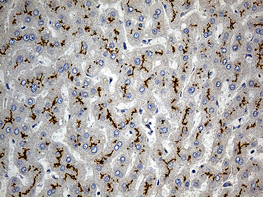 ABCC2 / MRP2 Antibody - Immunohistochemical staining of paraffin-embedded Human liver tissue within the normal limits using anti-ABCC2 mouse monoclonal antibody. (Heat-induced epitope retrieval by 1mM EDTA in 10mM Tris buffer. (pH8.5) at 120°C for 3 min. (1:5000)