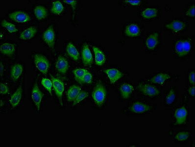 ABCC2 / MRP2 Antibody - Immunofluorescent analysis of A549 cells at a dilution of 1:100 and Alexa Fluor 488-congugated AffiniPure Goat Anti-Rabbit IgG(H+L)