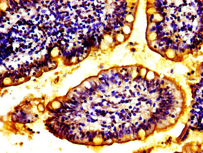 ABCC2 / MRP2 Antibody - IHC image of WWOX Antibody diluted at 1:100 and staining in paraffin-embedded human small intestine tissue performed on a Leica BondTM system. After dewaxing and hydration, antigen retrieval was mediated by high pressure in a citrate buffer (pH 6.0). Section was blocked with 10% normal goat serum 30min at RT. Then primary antibody (1% BSA) was incubated at 4°C overnight. The primary is detected by a biotinylated secondary antibody and visualized using an HRP conjugated SP system.