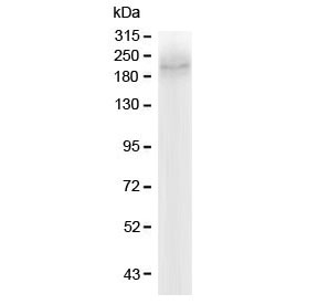 ABCC2 / MRP2 Antibody - Western blot testing of human Caco-2 lysate with MRP2 antibody at 0.5ug/ml. Predicted molecular weight: 174-250 kDa depending on degree of glycosylation.