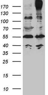 ABCC2 / MRP2 Antibody - HEK293T cells were transfected with the pCMV6-ENTRY control. (Left lane) or pCMV6-ENTRY ABCC2. (Right lane) cDNA for 48 hrs and lysed. Equivalent amounts of cell lysates. (5 ug per lane) were separated by SDS-PAGE and immunoblotted with anti-ABCC2 rabbit polyclonal antibody.