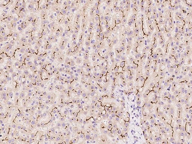 ABCC2 / MRP2 Antibody - Immunochemical staining of human ABCC2 in human liver with rabbit polyclonal antibody at 1:500 dilution, formalin-fixed paraffin embedded sections.