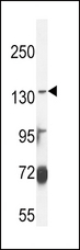 ABCC3 / MRP3 Antibody - ABCC3 Antibody western blot of MDA-MB435 cell line lysates (35 ug/lane). The ABCC3 antibody detected the ABCC3 protein (arrow).