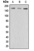ABCC3 / MRP3 Antibody - Western blot analysis of MRP3 expression in HepG2 (A); MCF7 (B); MDAMB435 (C) whole cell lysates.
