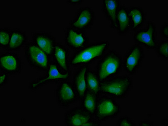 ABCC3 / MRP3 Antibody - Immunofluorescent analysis of A549 cells a at a dilution of 1:100 and Alexa Fluor 488-congugated AffiniPure Goat Anti-Rabbit IgG(H+L)
