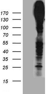 ABCC3 / MRP3 Antibody - HEK293T cells were transfected with the pCMV6-ENTRY control. (Left lane) or pCMV6-ENTRY ABCC3. (Right lane) cDNA for 48 hrs and lysed