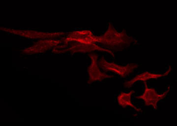 ABCC3 / MRP3 Antibody - Staining HeLa cells by IF/ICC. The samples were fixed with PFA and permeabilized in 0.1% Triton X-100, then blocked in 10% serum for 45 min at 25°C. The primary antibody was diluted at 1:200 and incubated with the sample for 1 hour at 37°C. An Alexa Fluor 594 conjugated goat anti-rabbit IgG (H+L) Ab, diluted at 1/600, was used as the secondary antibody.