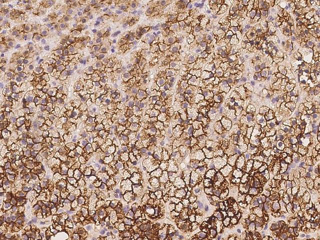 ABCC3 / MRP3 Antibody - Immunochemical staining of human ABCC3 in human adrenal gland with rabbit polyclonal antibody at 1:500 dilution, formalin-fixed paraffin embedded sections.