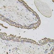 ABCC3 / MRP3 Antibody - Immunohistochemistry of paraffin-embedded Human prostate using ABCC3 Polyclonal Antibody at dilution of 1:100 (40x lens).