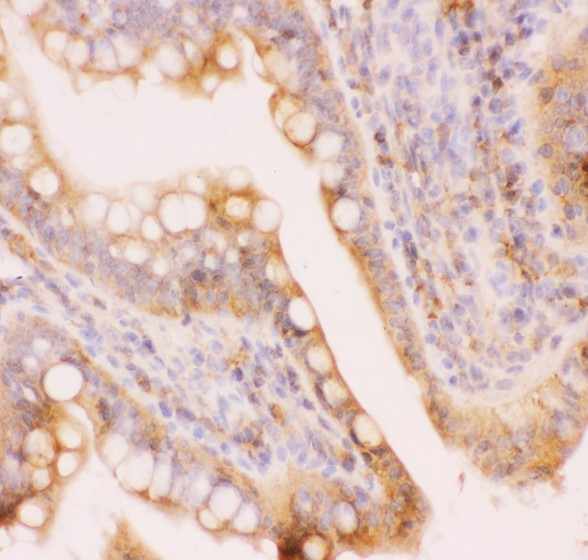 ABCC4 / MRP4 Antibody - MRP4 antibody IHC-paraffin: Rat Intestine Tissue.