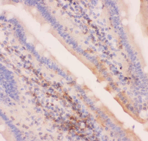 ABCC4 / MRP4 Antibody - MRP4 antibody IHC-paraffin: Mouse Intestine Tissue.