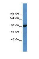 ABCC4 / MRP4 Antibody - ABCC4 / MRP4 antibody Western blot of 721_B Cell lysate. Antibody concentration 1 ug/ml.  This image was taken for the unconjugated form of this product. Other forms have not been tested.