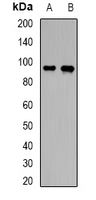 ABCC4 / MRP4 Antibody - Western blot analysis of ABCC4 expression in SW460 (A); HeLa (B) whole cell lysates.