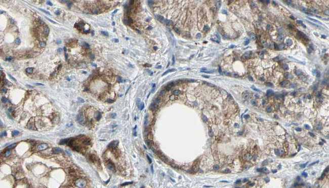 ABCC4 / MRP4 Antibody - 1:100 staining human prostate tissue by IHC-P. The sample was formaldehyde fixed and a heat mediated antigen retrieval step in citrate buffer was performed. The sample was then blocked and incubated with the antibody for 1.5 hours at 22°C. An HRP conjugated goat anti-rabbit antibody was used as the secondary.