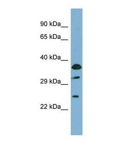ABCC5 / MRP5 Antibody - Western blot of Human COLO205. ABCC5 antibody dilution 1.0 ug/ml.  This image was taken for the unconjugated form of this product. Other forms have not been tested.
