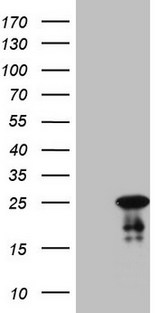 ABCC5 / MRP5 Antibody - HEK293T cells were transfected with the pCMV6-ENTRY control (Left lane) or pCMV6-ENTRY ABCC5 (Right lane) cDNA for 48 hrs and lysed. Equivalent amounts of cell lysates (5 ug per lane) were separated by SDS-PAGE and immunoblotted with anti-ABCC5 (1:2000).