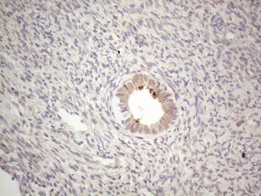 ABCC5 / MRP5 Antibody - Immunohistochemical staining of paraffin-embedded Human endometrium tissue within the normal limits using anti-ABCC5 mouse monoclonal antibody. (Heat-induced epitope retrieval by 1mM EDTA in 10mM Tris buffer. (pH8.5) at 120°C for 3 min. (1:150)
