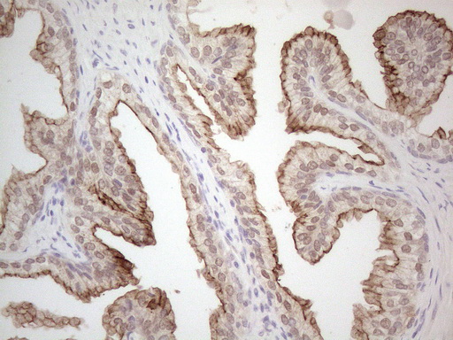 ABCC5 / MRP5 Antibody - Immunohistochemical staining of paraffin-embedded Human prostate tissue within the normal limits using anti-ABCC5 mouse monoclonal antibody. (Heat-induced epitope retrieval by 1mM EDTA in 10mM Tris buffer. (pH8.5) at 120°C for 3 min. (1:150)
