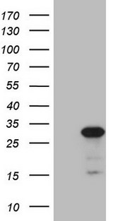 ABCC5 / MRP5 Antibody - HEK293T cells were transfected with the pCMV6-ENTRY control. (Left lane) or pCMV6-ENTRY ABCC5. (Right lane) cDNA for 48 hrs and lysed