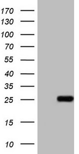 ABCC5 / MRP5 Antibody - HEK293T cells were transfected with the pCMV6-ENTRY control. (Left lane) or pCMV6-ENTRY ABCC5. (Right lane) cDNA for 48 hrs and lysed