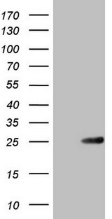ABCC5 / MRP5 Antibody - HEK293T cells were transfected with the pCMV6-ENTRY control. (Left lane) or pCMV6-ENTRY ABCC5. (Right lane) cDNA for 48 hrs and lysed. Equivalent amounts of cell lysates. (5 ug per lane) were separated by SDS-PAGE and immunoblotted with anti-ABCC5. (1:2000)