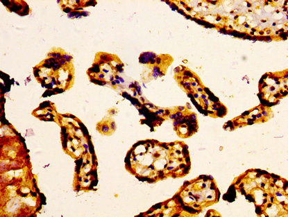 ABCC5 / MRP5 Antibody - Immunohistochemistry image at a dilution of 1:400 and staining in paraffin-embedded human placenta tissue performed on a Leica BondTM system. After dewaxing and hydration, antigen retrieval was mediated by high pressure in a citrate buffer (pH 6.0) . Section was blocked with 10% normal goat serum 30min at RT. Then primary antibody (1% BSA) was incubated at 4 °C overnight. The primary is detected by a biotinylated secondary antibody and visualized using an HRP conjugated SP system.