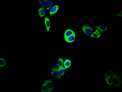ABCC5 / MRP5 Antibody - Immunofluorescence staining of PC-3 cells with ABCC5 Antibody at 1:133, counter-stained with DAPI. The cells were fixed in 4% formaldehyde, permeabilized using 0.2% Triton X-100 and blocked in 10% normal Goat Serum. The cells were then incubated with the antibody overnight at 4°C. The secondary antibody was Alexa Fluor 488-congugated AffiniPure Goat Anti-Rabbit IgG(H+L).