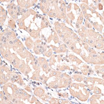 ABCC5 / MRP5 Antibody - Immunohistochemistry of paraffin-embedded Human stomach using ABCC5 Polyclonal Antibody at dilution of 1:100 (40x lens).
