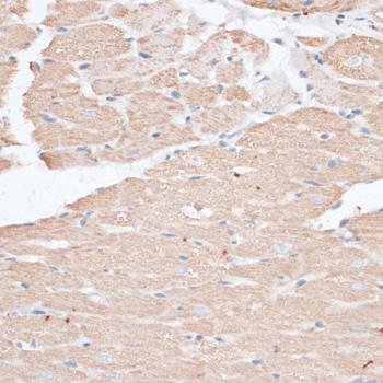 ABCC5 / MRP5 Antibody - Immunohistochemistry of paraffin-embedded Rat heart using ABCC5 Polyclonal Antibody at dilution of 1:100 (40x lens).