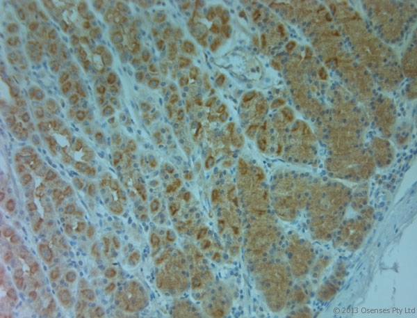 ABCC6 / MRP6 Antibody - Rabbit antibody to ABCC6 (825-875). IHC on paraffin sections of human stomach tissue using Rabbit antibody to ABCC6 (825-875). HIER: 1 mM EDTA, pH 8 for 20 min using Thermo PT Module. Blocking: 0.2% LFDM in TBST filtered through a 0.2 micron filter. Detection was done using Novolink HRP polymer from Leica following manufacturer's instructions. Primary antibody: dilution 1:1000, incubated 30 min at RT (using Autostainer). Sections were counterstained with Harris Hematoxylin.