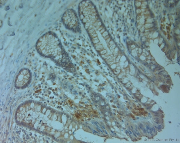 ABCC6 / MRP6 Antibody - Rabbit antibody to ABCC6 (825-875). IHC on paraffin sections of human large intestine tissue using Rabbit antibody to ABCC6 (825-875). HIER: 1 mM EDTA, pH 8 for 20 min using Thermo PT Module. Blocking: 0.2% LFDM in TBST filtered through a 0.2 micron filter. Detection was done using Novolink HRP polymer from Leica following manufacturer's instructions. Primary antibody: dilution 1:1000, incubated 30 min at RT (using Autostainer). Sections were counterstained with Harris Hematoxylin.