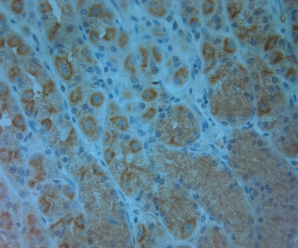 ABCC6 / MRP6 Antibody - Rabbit antibody to ABCC6 (825-875). IHC on paraffin sections of human stomach tissue using Rabbit antibody to ABCC6 (825-875) . HIER: 1 mM EDTA, pH 8 for 20 min using Thermo PT Module. Blocking: 0.2% LFDM in TBST filtered through a 0.2 micron filter. Detection was done using Novolink HRP polymer from Leica following manufacturer's instructions. Primary antibody: dilution 1:1000, incubated 30 min at RT (using Autostainer). Sections were counterstained with Harris Hematoxylin.