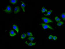 ABCC6 / MRP6 Antibody - Immunofluorescence staining of A549 cells diluted at 1:133, counter-stained with DAPI. The cells were fixed in 4% formaldehyde, permeabilized using 0.2% Triton X-100 and blocked in 10% normal Goat Serum. The cells were then incubated with the antibody overnight at 4°C.The Secondary antibody was Alexa Fluor 488-congugated AffiniPure Goat Anti-Rabbit IgG (H+L).