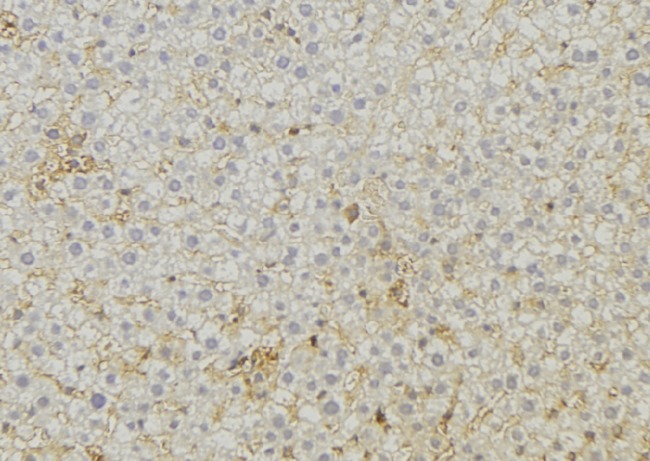 ABCC6 / MRP6 Antibody - 1:100 staining mouse liver tissue by IHC-P. The sample was formaldehyde fixed and a heat mediated antigen retrieval step in citrate buffer was performed. The sample was then blocked and incubated with the antibody for 1.5 hours at 22°C. An HRP conjugated goat anti-rabbit antibody was used as the secondary.