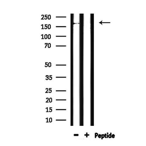 ABCC6 / MRP6 Antibody - Western blot analysis of extracts of mouse muscle using MRP6 antibody.