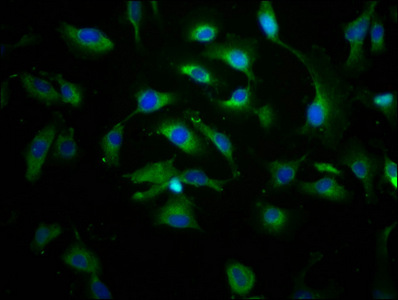ABCC8 / SUR1 Antibody - Immunofluorescence staining of U251 cells at a dilution of 1:166, counter-stained with DAPI. The cells were fixed in 4% formaldehyde, permeabilized using 0.2% Triton X-100 and blocked in 10% normal Goat Serum. The cells were then incubated with the antibody overnight at 4 °C.The secondary antibody was Alexa Fluor 488-congugated AffiniPure Goat Anti-Rabbit IgG (H+L) .