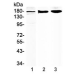 ABCC8 / SUR1 Antibody - Western blot testing of 1) human placenta, 2) rat brain and 3) mouse brain lysate with SUR1 antibody at 0.5ug/ml. Predicted molecular weight ~177 kDa.