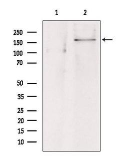 ABCC8 / SUR1 Antibody - Western blot analysis of extracts of HepG2 cells using ABCC8 antibody. Lane 1 was treated with the blocking peptide.