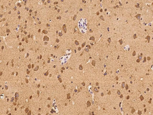 ABCC8 / SUR1 Antibody - Immunochemical staining of human ABCC8 in human brain with rabbit polyclonal antibody at 1:100 dilution, formalin-fixed paraffin embedded sections.