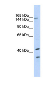 ABCC8 / SUR1 Antibody - ABCC8 / MRP8 antibody Western blot of 293T cell lysate. This image was taken for the unconjugated form of this product. Other forms have not been tested.