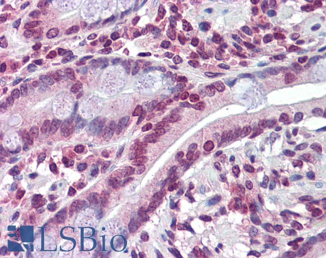 ABCC8 / SUR1 Antibody - Anti-ABCC8 antibody IHC of human small intestine. Immunohistochemistry of formalin-fixed, paraffin-embedded tissue after heat-induced antigen retrieval. Antibody concentration 5 ug/ml.  This image was taken for the unconjugated form of this product. Other forms have not been tested.