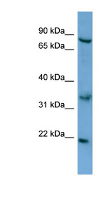 ABCD2 / ALDR Antibody - ABCD2 antibody Western blot of HepG2 cell lysate. This image was taken for the unconjugated form of this product. Other forms have not been tested.