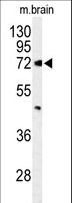 ABCD2 / ALDR Antibody - Western blot of ABCD2 Antibody in mouse brain tissue lysates (35 ug/lane). ABCD2 (arrow) was detected using the purified antibody.