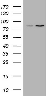 ABCD2 / ALDR Antibody - HEK293T cells were transfected with the pCMV6-ENTRY control. (Left lane) or pCMV6-ENTRY ABCD2. (Right lane) cDNA for 48 hrs and lysed. Equivalent amounts of cell lysates. (5 ug per lane) were separated by SDS-PAGE and immunoblotted with anti-ABCD2. (1:500)