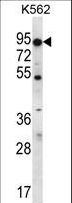 ABCD2 / ALDR Antibody - ABCD2 Antibody western blot of K562 cell line lysates (35 ug/lane). The ABCD2 antibody detected the ABCD2 protein (arrow).