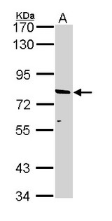 ABCD2 / ALDR Antibody - Sample (30 ug of whole cell lysate). A: A431. 7.5% SDS PAGE. ABCD2 antibody diluted at 1:1000. 