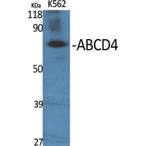 ABCD4 Antibody - Western blot of ABCD4 antibody